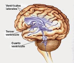 Ventrículos laterales grandes